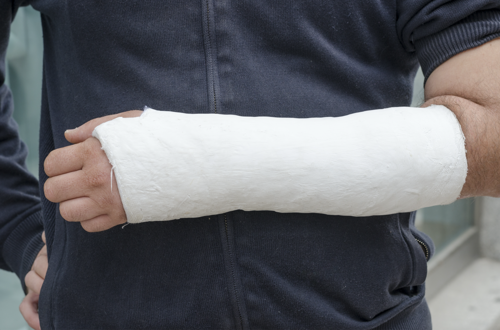 Screen Shot 2020-06-05 at 12.37.45 man with an injury in a cast after an accident
